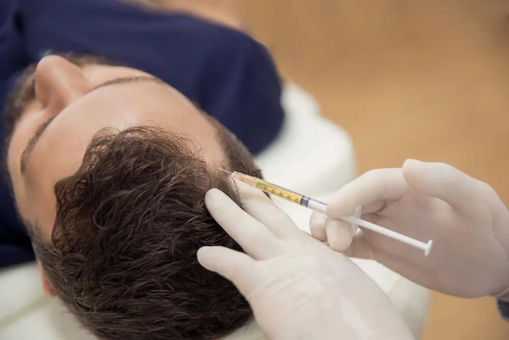 PRP hair restoration treatment on the scalp