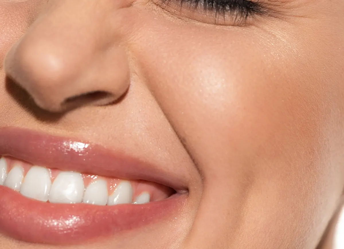 Close-up of a natural smile with soft smile lines